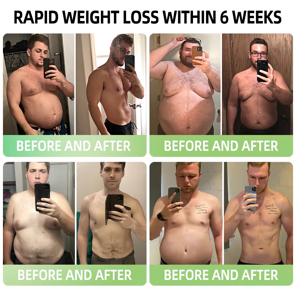 𝐓𝐋𝐎𝐏𝐀® 𝐆𝐋𝐏-𝟏 𝐒𝐥𝐢𝐦𝐦𝐢𝐧𝐠 & 𝐇𝐞𝐚𝐥𝐭𝐡 𝐁𝐨𝐨𝐬𝐭 𝐃𝐫𝐨𝐩𝐬👨‍⚕️(𝐅𝐨𝐨𝐝-𝐠𝐫𝐚𝐝𝐞 𝐅𝐚𝐭 𝐁𝐮𝐫𝐧𝐞𝐫)