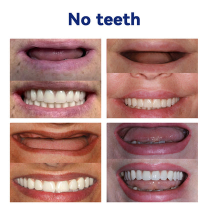 𝐵𝑖𝑘𝑒𝑛𝑑𝑎™ 𝑆𝑖𝑙𝑖𝑐𝑜𝑛𝑒 𝐷𝑒𝑛𝑡𝑢𝑟𝑒 𝑅𝑢𝑙𝑒𝑟 𝑆𝑒𝑡 (👩‍🔬👩‍🔬BDA 𝐶𝑜𝑚𝑝𝑙𝑖𝑎𝑛𝑡 𝐴𝑝𝑝𝑟𝑜𝑣𝑒𝑑 𝐵𝑦 𝑃𝑟𝑜𝑓𝑒𝑠𝑠𝑖𝑜𝑛𝑎𝑙 𝐷𝑒𝑛𝑡𝑖𝑠𝑡𝑠）🔥🔥