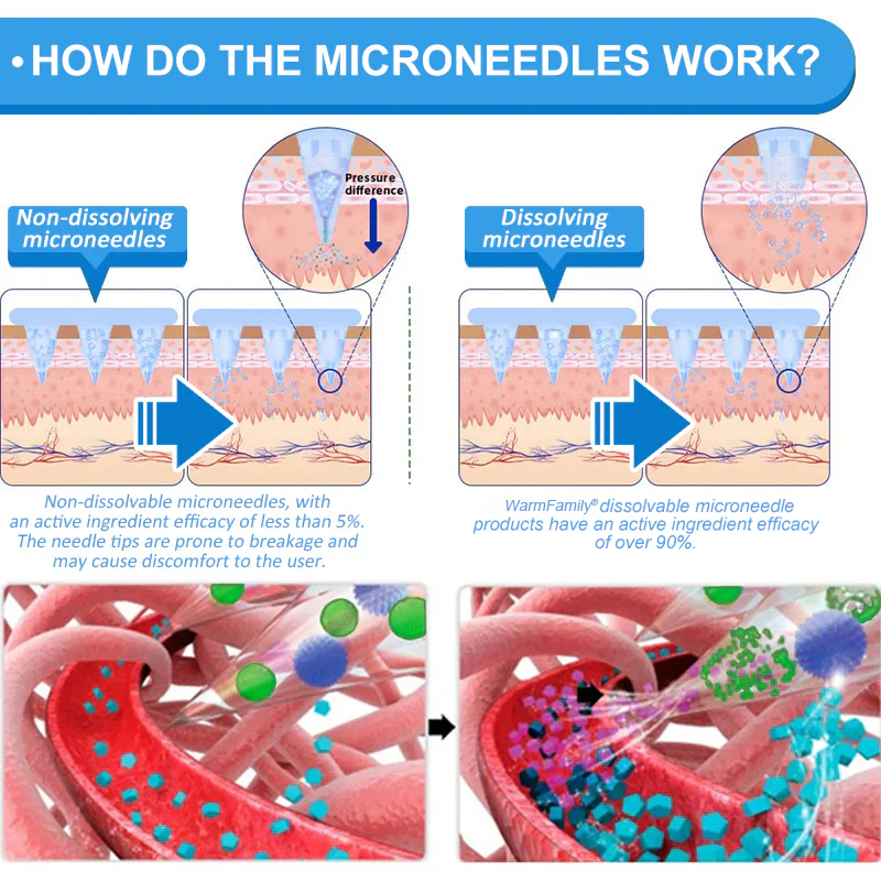 WarmFamily® SMGT-GLP-1 Nano Microneedle Patch with Collagen & Matrixyl 3000 ✅ | Clinically Proven for Weight Loss, Cardiovascular Health, Diabetes, and More Health Issues, Doctor Recommended👨‍⚕️👨‍⚕️