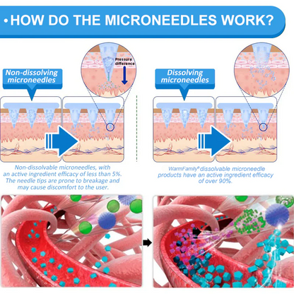 WarmFamily® SMGT-GLP-1 Nano Microneedle Patch with Collagen & Matrixyl 3000 ✅ | Clinically Proven for Weight Loss, Cardiovascular Health, Diabetes, and More Health Issues, Doctor Recommended👨‍⚕️👨‍⚕️