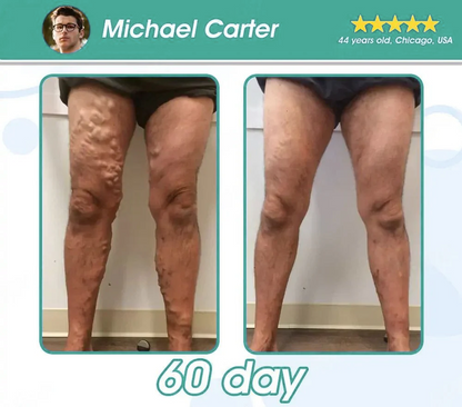 [Official Store] WarmFamily® GLP-1 Slimming Essence Pearls 🍏｜Triple Action: NAD⁺, Moringa & ACV｜⚡ Fast Fat Burn & Metabolic Balance｜Backed by Obesity Research Experts