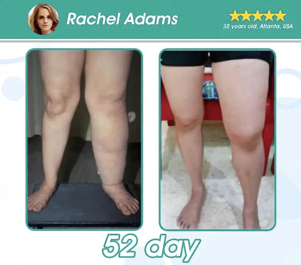 [Official Store] WarmFamily® GLP-1 Slimming Essence Pearls 🍏｜Triple Action: NAD⁺, Moringa & ACV｜⚡ Fast Fat Burn & Metabolic Balance｜Backed by Obesity Research Experts