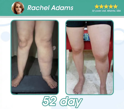 [Official Store] WarmFamily® GLP-1 Slimming Essence Pearls 🍏｜Triple Action: NAD⁺, Moringa & ACV｜⚡ Fast Fat Burn & Metabolic Balance｜Backed by Obesity Research Experts