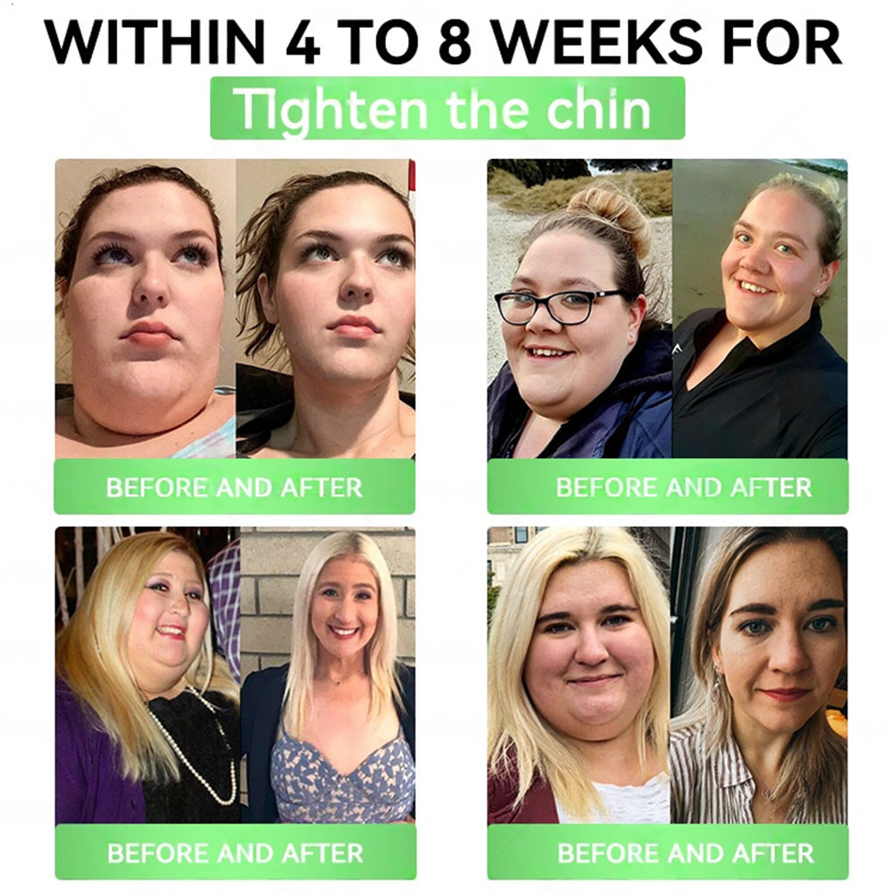 𝑶𝒏𝒍𝒊𝒏𝒆 𝑷𝒉𝒂𝒓𝒎𝒂𝒄𝒚 | 🇬🇧𝙈𝙖𝙮𝙤𝙂𝙪𝙤𝙟𝙞®𝙏𝙧𝙞𝙥𝙚𝙥𝙩𝙞𝙙𝙚 𝙂𝙇𝙋-𝟭 𝙈𝙚𝙩𝙖𝙗𝙤𝙁𝙞𝙧𝙢 𝙊𝙧𝙖𝙡 𝘿𝙧𝙤𝙥𝙨 (𝑂𝑛𝑐𝑒 𝑎 𝑑𝑎𝑦, 𝑣𝑖𝑠𝑖𝑏𝑙𝑒 𝑟𝑒𝑠𝑢𝑙𝑡𝑠 𝑖𝑛 7 𝑑𝑎𝑦𝑠) ✅𝗦𝘂𝗽𝗽𝗼𝗿𝘁𝘀 𝗼𝗯𝗲𝘀𝗶𝘁𝘆, 𝗰𝗮𝗿𝗱𝗶𝗼𝘃𝗮𝘀𝗰𝘂𝗹𝗮𝗿 𝗵𝗲𝗮𝗹𝘁𝗵, 𝗱𝗶𝗮𝗯𝗲𝘁𝗲𝘀, 𝘀𝗹𝗲𝗲𝗽 𝗮𝗽𝗻𝗲𝗮, 𝗴𝘂𝘁 𝗵𝗲𝗮𝗹𝘁𝗵, 𝗷𝗼𝗶𝗻𝘁 𝗶𝘀𝘀𝘂𝗲𝘀, 𝐰𝐡𝐢𝐥𝐞 𝐚𝐥𝐬𝐨 𝐟𝐢𝐫𝐦𝐢𝐧𝐠 𝐭𝐡𝐞 𝐬𝐤𝐢𝐧 𝐚𝐧𝐝 𝐛𝐨𝐨𝐬𝐭𝐢𝐧𝐠 𝐞𝐧𝐞𝐫𝐠𝐲