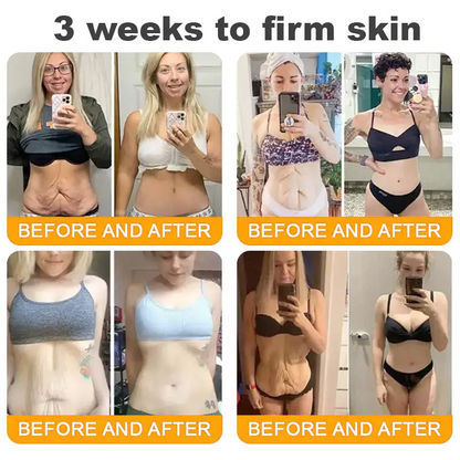 Made and Shipped from UK ✨ TLOPA® Bee Venom Skin Restoration Cream ⏰ LAST DAY 80% OFF💞