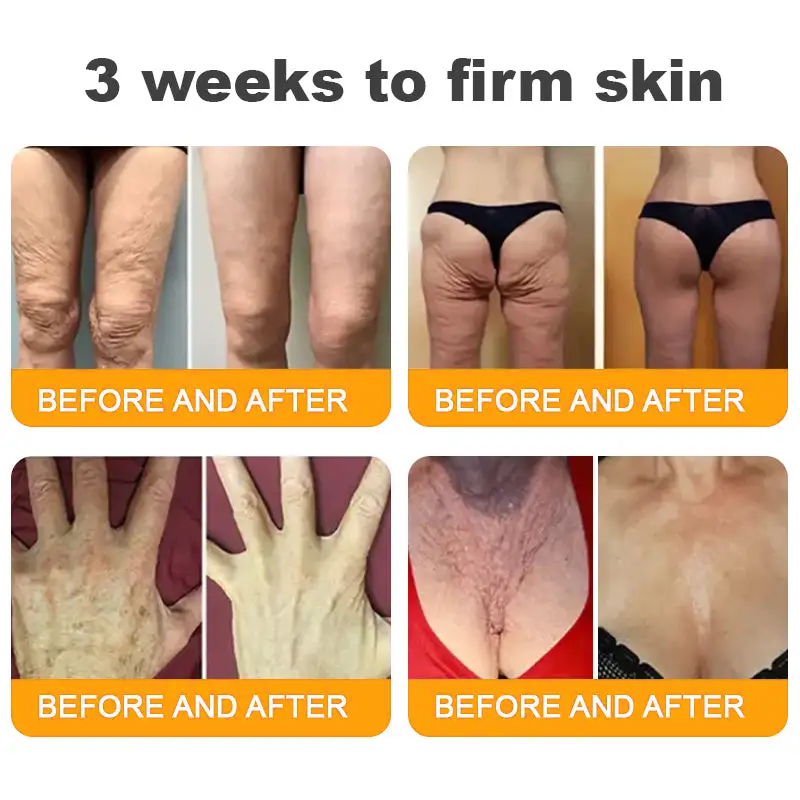 Made and Shipped from UK ✨ TLOPA® Bee Venom Skin Restoration Cream ⏰ LAST DAY 80% OFF💞