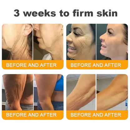 Made and Shipped from UK ✨ TLOPA® Bee Venom Skin Restoration Cream ⏰ LAST DAY 80% OFF💞