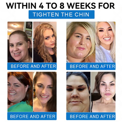 WarmFamily® SMGT-GLP-1 Nano Microneedle Patch with Collagen & Matrixyl 3000 ✅ | Clinically Proven for Weight Loss, Cardiovascular Health, Diabetes, and More Health Issues, Doctor Recommended👨‍⚕️👨‍⚕️